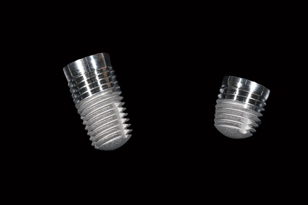 exemple implants dentaires exemple implants dentaires